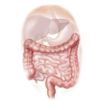 Thảo dược cho đường ruột